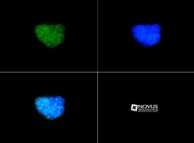 Immunocytochemistry/ Immunofluorescence: Histone H3 [p Thr6, Dimethyl Lys9] Antibody [NB21-1053]